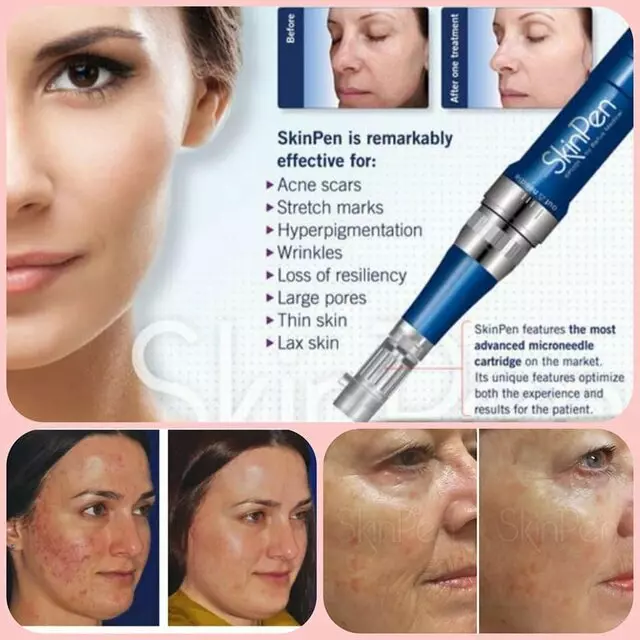 Advantage Dermatology