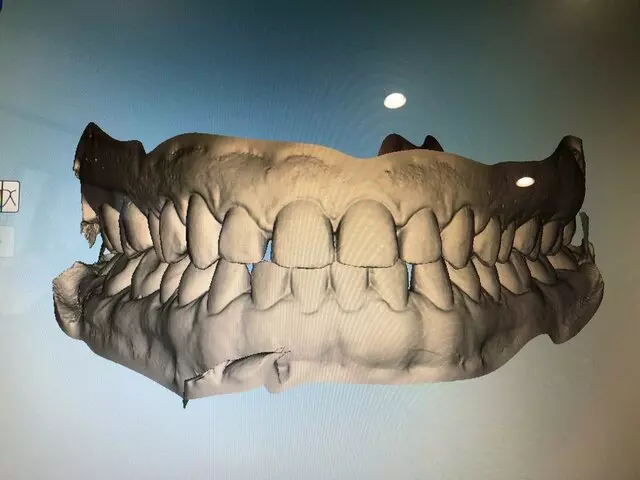 Smile Direct Club