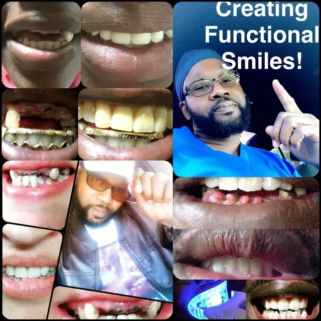 Athill’s Denture Cleaning & Repair