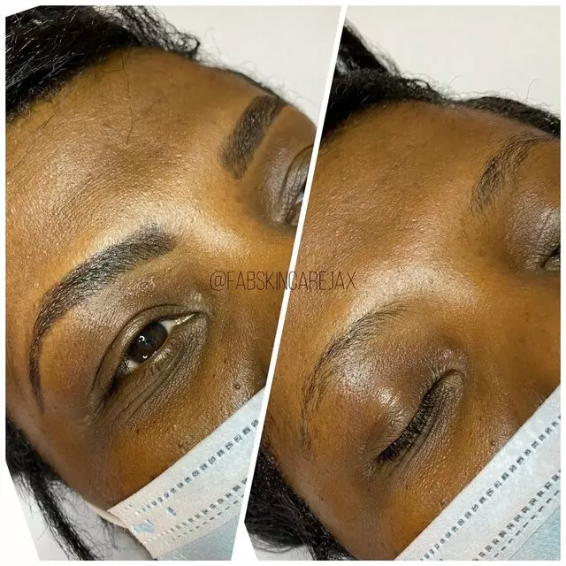 Fab Skincare